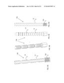 DEVICE, SYSTEM AND METHOD FOR PROSTHODONTIC RESTORATION diagram and image