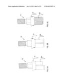 DEVICE, SYSTEM AND METHOD FOR PROSTHODONTIC RESTORATION diagram and image