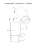 DEVICE, SYSTEM AND METHOD FOR PROSTHODONTIC RESTORATION diagram and image