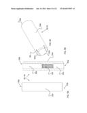 DEVICE, SYSTEM AND METHOD FOR PROSTHODONTIC RESTORATION diagram and image