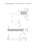 DEVICE, SYSTEM AND METHOD FOR PROSTHODONTIC RESTORATION diagram and image