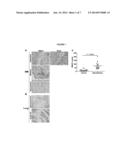 BIOMARKER OF ASBESTOS EXPOSURE AND MESOTHELIOMA diagram and image