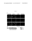 BIOMARKER OF ASBESTOS EXPOSURE AND MESOTHELIOMA diagram and image