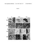 BIOMARKER OF ASBESTOS EXPOSURE AND MESOTHELIOMA diagram and image