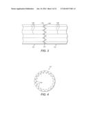 Methods and Apparatuses for Manufacture of Smoking Article Filters diagram and image