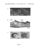 INHIBITORS OF NCCA-ATP CHANNELS FOR THERAPY diagram and image