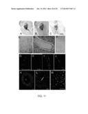 INHIBITORS OF NCCA-ATP CHANNELS FOR THERAPY diagram and image