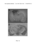 INHIBITORS OF NCCA-ATP CHANNELS FOR THERAPY diagram and image