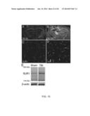 INHIBITORS OF NCCA-ATP CHANNELS FOR THERAPY diagram and image