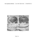 INHIBITORS OF NCCA-ATP CHANNELS FOR THERAPY diagram and image