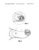 SURGICAL INSTRUMENT WITH ELONGATED CHANNEL diagram and image