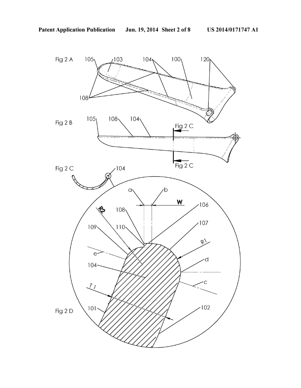 ADVANCED SURGICAL INSTRUMENT SUCH AS A SPECULUM - diagram, schematic, and image 03