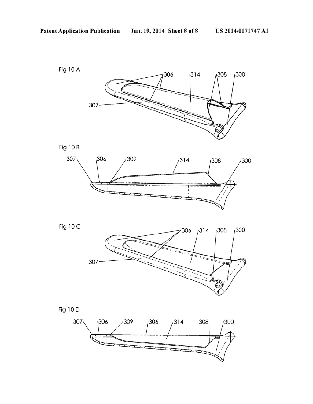 ADVANCED SURGICAL INSTRUMENT SUCH AS A SPECULUM - diagram, schematic, and image 09