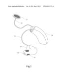 EEG MONITOR WITH CAPACTIVE ELECTRODES AND A METHOD OF MONITORING BRAIN     WAVES diagram and image