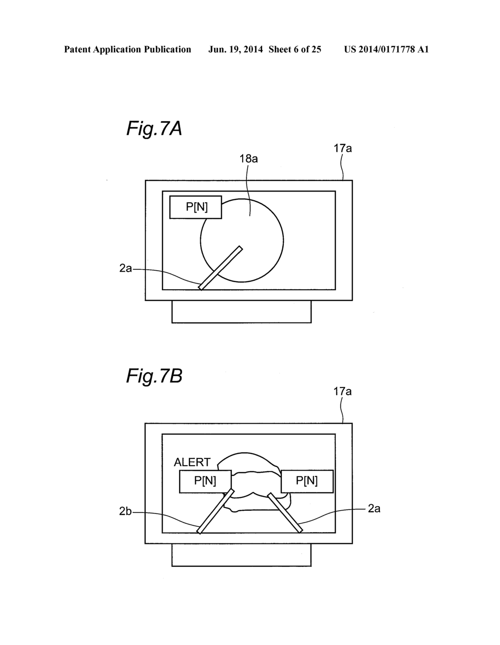 FORCE MEASUREMENT APPARATUS, FORCE MEASUREMENT METHOD, FORCE MEASUREMENT     PROGRAM, FORCE MEASUREMENT INTEGRATED ELECTRONIC CIRCUIT, AND     MASTER-SLAVE DEVICE - diagram, schematic, and image 07