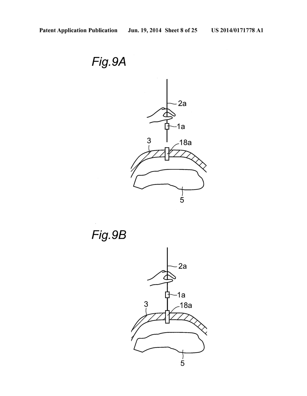 FORCE MEASUREMENT APPARATUS, FORCE MEASUREMENT METHOD, FORCE MEASUREMENT     PROGRAM, FORCE MEASUREMENT INTEGRATED ELECTRONIC CIRCUIT, AND     MASTER-SLAVE DEVICE - diagram, schematic, and image 09