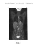 NUCLEAR MEDICINE DIAGNOSTIC APPARATUS, DIAGNOSTIC IMAGING APPARATUS, AND     IMAGE PROCESSING METHOD diagram and image