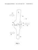 ORTHOTIC BRACE diagram and image