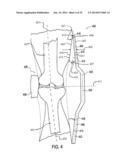 ORTHOTIC BRACE diagram and image