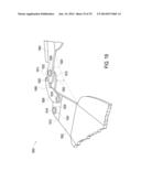 ORTHOTIC BRACE diagram and image