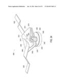 ORTHOTIC BRACE diagram and image