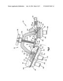 FINGER ORTHOSIS diagram and image