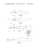 TROCAR AND TROCAR-NEEDLE INTEGRATED SYSTEM FOR GLAUCOMA DRAINAGE SURGERY diagram and image