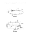 CATHETER SYSTEM PROVIDING STEP REDUCTION FOR POSTCONDITIONING diagram and image