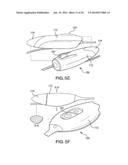 CATHETER SYSTEM PROVIDING STEP REDUCTION FOR POSTCONDITIONING diagram and image