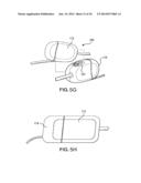 CATHETER SYSTEM PROVIDING STEP REDUCTION FOR POSTCONDITIONING diagram and image