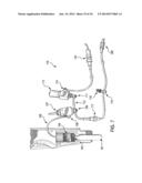 CATHETER SYSTEM PROVIDING STEP REDUCTION FOR POSTCONDITIONING diagram and image