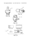 CATHETER SYSTEM PROVIDING STEP REDUCTION FOR POSTCONDITIONING diagram and image