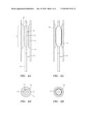 DRUG-ELUTING ANGIOPLASTY BALLOON SYSTEMS diagram and image