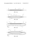 DRUG-ELUTING ANGIOPLASTY BALLOON SYSTEMS diagram and image