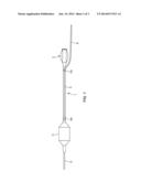 CATHETER WITH ADJUSTABLE GUIDEWIRE EXIT POSITION diagram and image