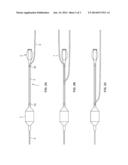 CATHETER WITH ADJUSTABLE GUIDEWIRE EXIT POSITION diagram and image