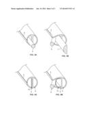 CATHETER WITH ADJUSTABLE GUIDEWIRE EXIT POSITION diagram and image