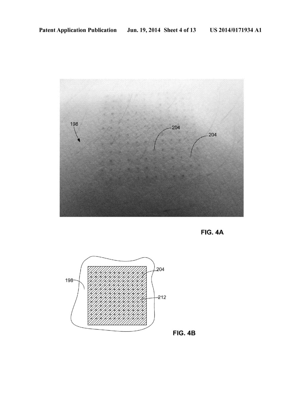 DISPOSABLE ELECTROMAGNETIC ENERGY APPLICATOR - diagram, schematic, and image 05