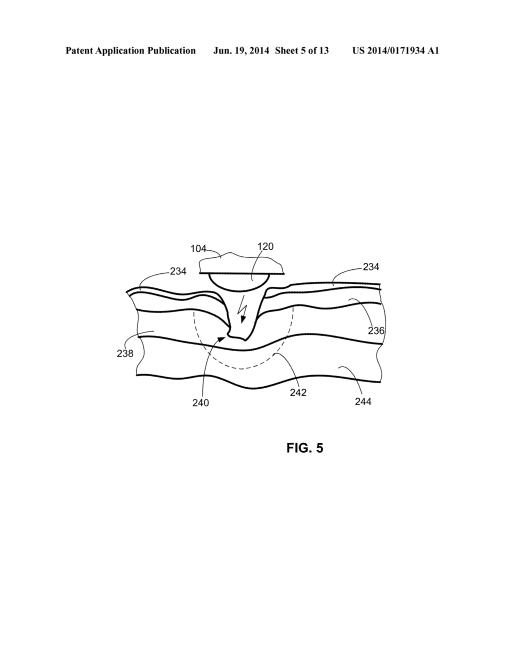 DISPOSABLE ELECTROMAGNETIC ENERGY APPLICATOR - diagram, schematic, and image 06