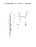 SYSTEMS AND METHODS FOR TREATING A HOLLOW ANATOMICAL STRUCTURE diagram and image