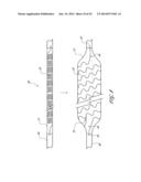 SYSTEMS AND METHODS FOR TREATING A HOLLOW ANATOMICAL STRUCTURE diagram and image