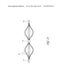 SYSTEMS AND METHODS FOR TREATING A HOLLOW ANATOMICAL STRUCTURE diagram and image