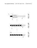 SYSTEMS AND METHODS FOR TREATING A HOLLOW ANATOMICAL STRUCTURE diagram and image