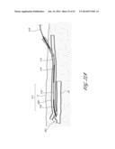 SYSTEMS AND METHODS FOR TREATING A HOLLOW ANATOMICAL STRUCTURE diagram and image