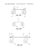 SYSTEMS AND METHODS FOR TREATING A HOLLOW ANATOMICAL STRUCTURE diagram and image