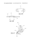 SYSTEMS AND METHODS FOR TREATING A HOLLOW ANATOMICAL STRUCTURE diagram and image