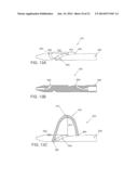 Systems and Methods for Cable-Based Tissue Removal diagram and image