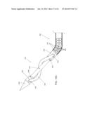 Systems and Methods for Cable-Based Tissue Removal diagram and image