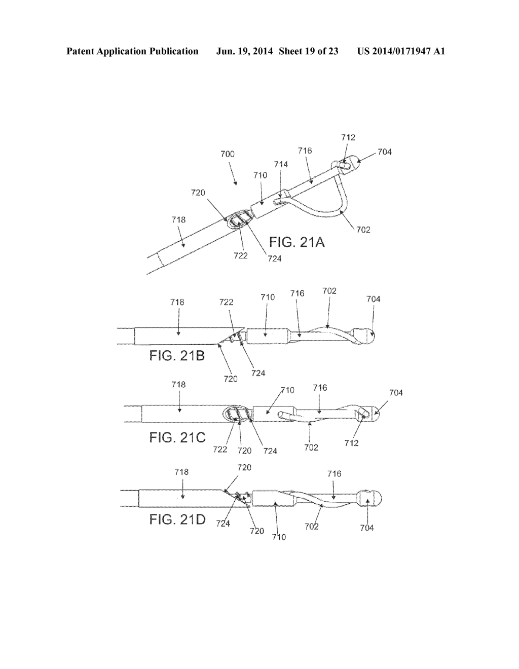 Systems and Methods for Cable-Based Tissue Removal - diagram, schematic, and image 20