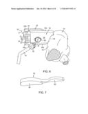 External Tibial Mill Guide and Method of Use diagram and image